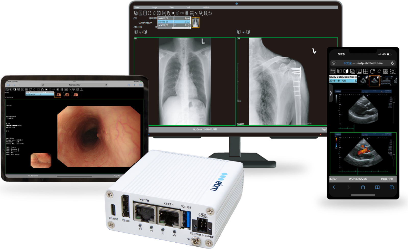 EBM mAIn PACS shown on diagnostic monitor, iPad and iPhone with the EPS Pi edge appliance — chest X-ray, endoscopy and ultrasound studies